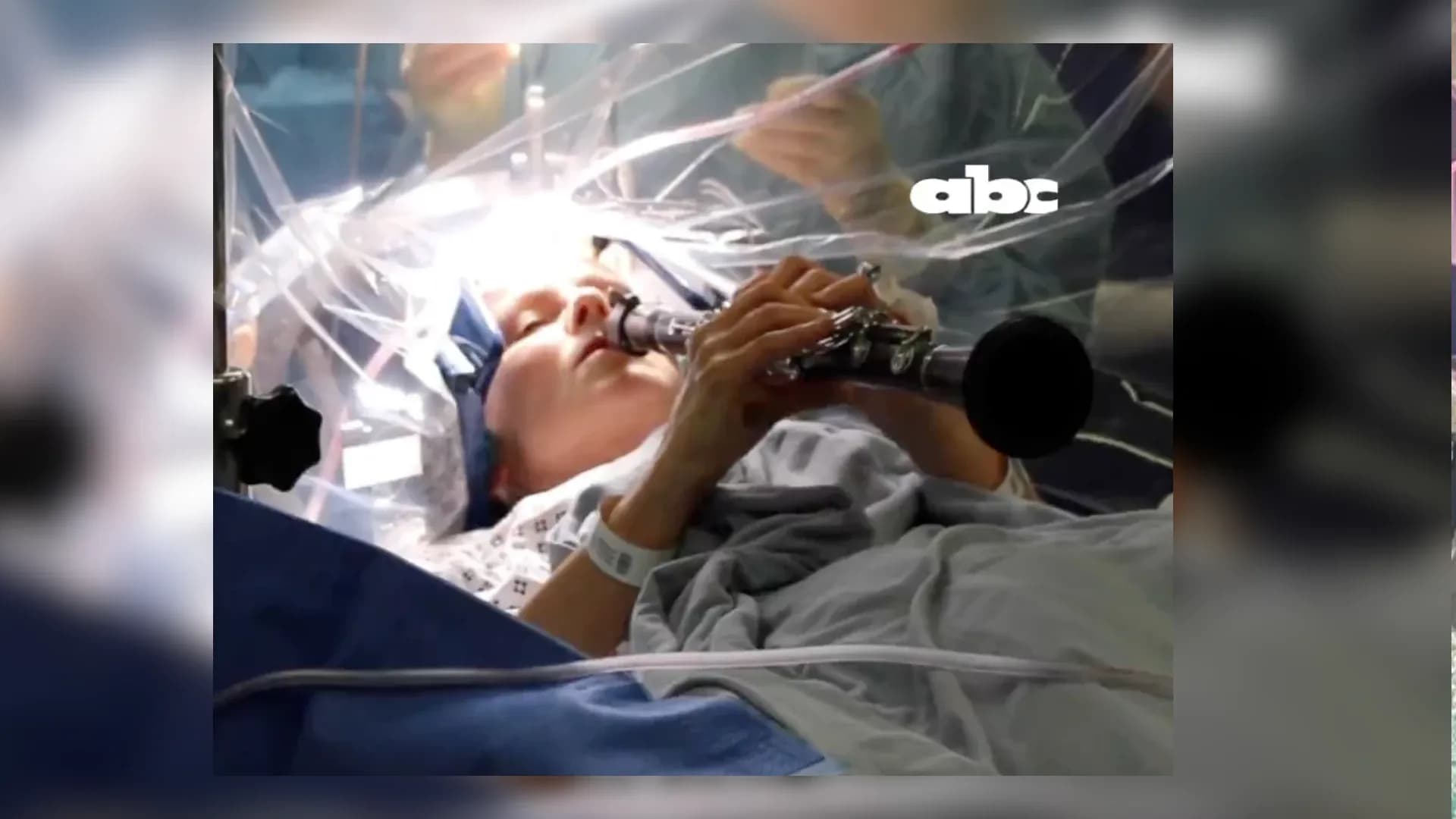 مريضة باركنسون تعزف الكلارينيت أثناء خضوعها لعملية جراحية.. فيديو