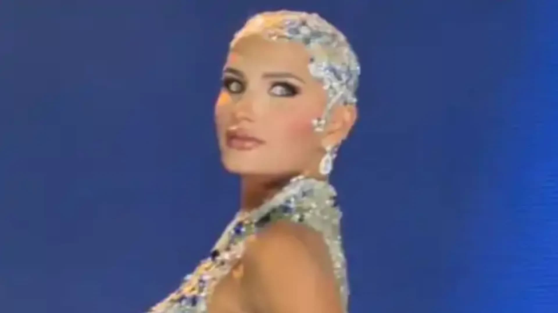 شابة امريكية تتحدى مرض الثعلبة لتصبح اول متسابقة لـ Miss USA حليقة الرأس... فيديو