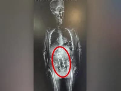 رجل في فلوريدا يُقبض عليه عاريًا... مع ثرموس مخفي في منطقة الشرج!