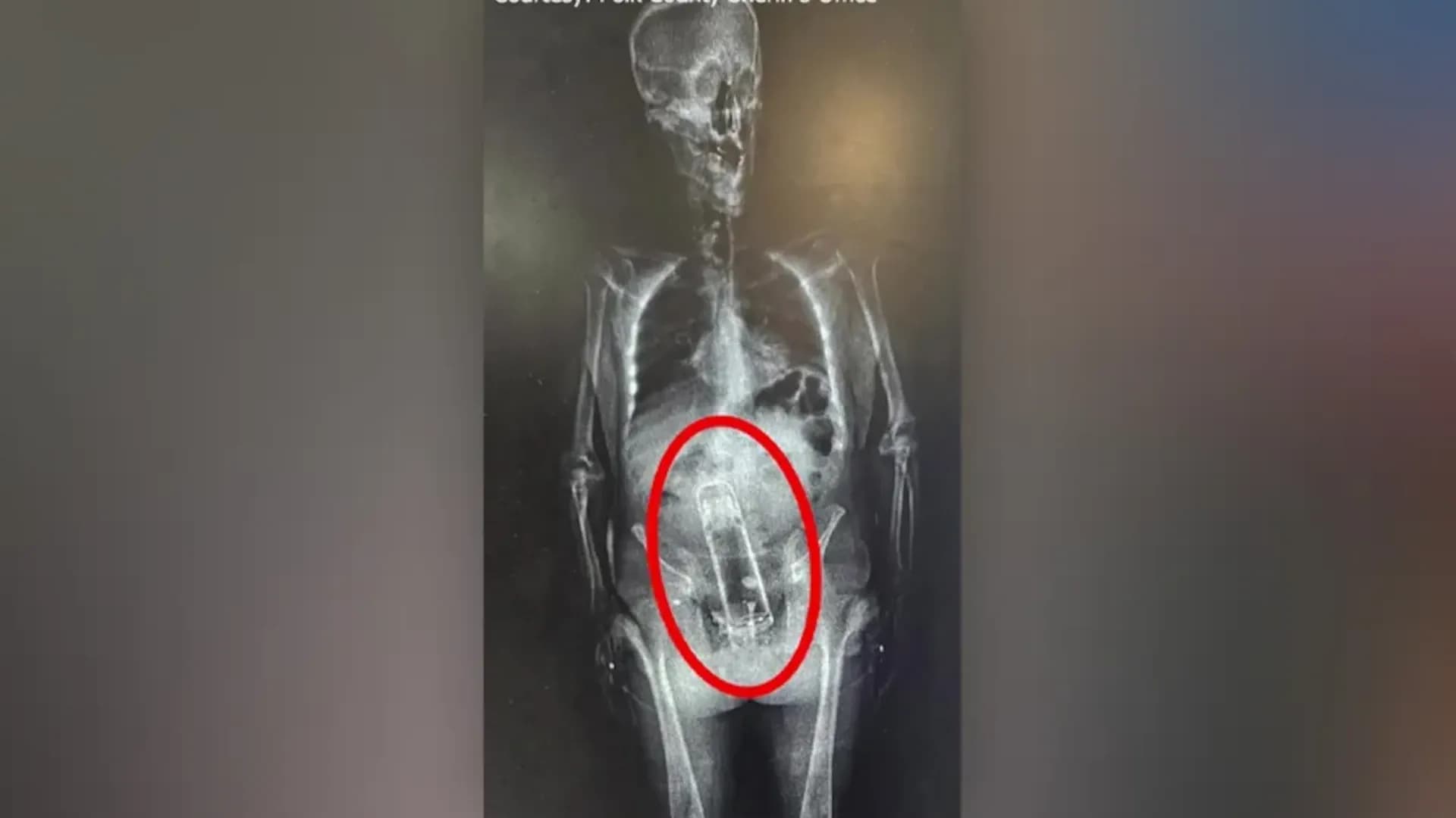 رجل في فلوريدا يُقبض عليه عاريًا... مع ثرموس مخفي في منطقة الشرج!